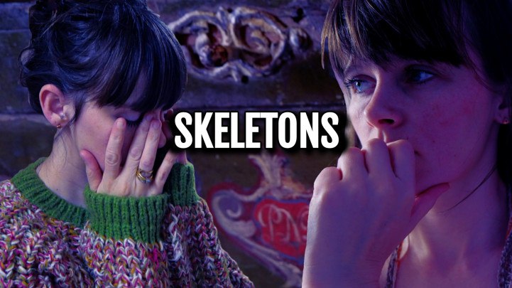 Sydney Harwin - Esqueleto